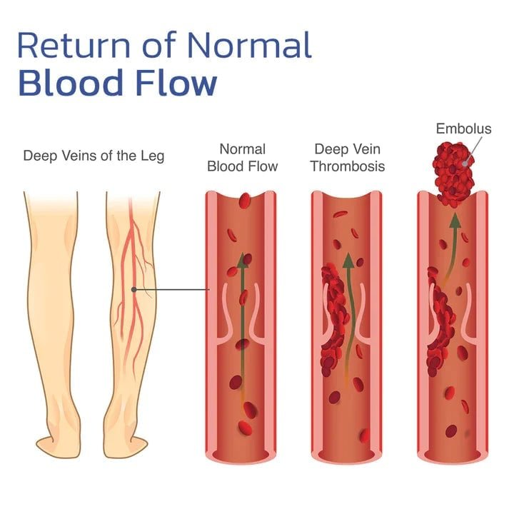 Ginocchiera riscaldante: sollievo rapido dal dolore