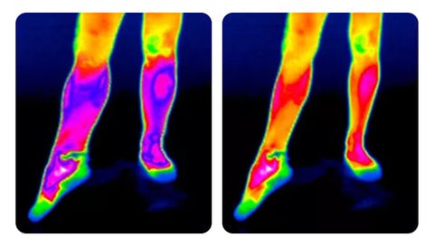 Ginocchiera riscaldante: sollievo rapido dal dolore