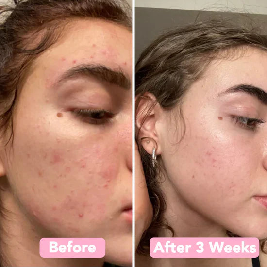 ספוג כורכום – עור נקי ומטוהר באופן טבעי (x40)