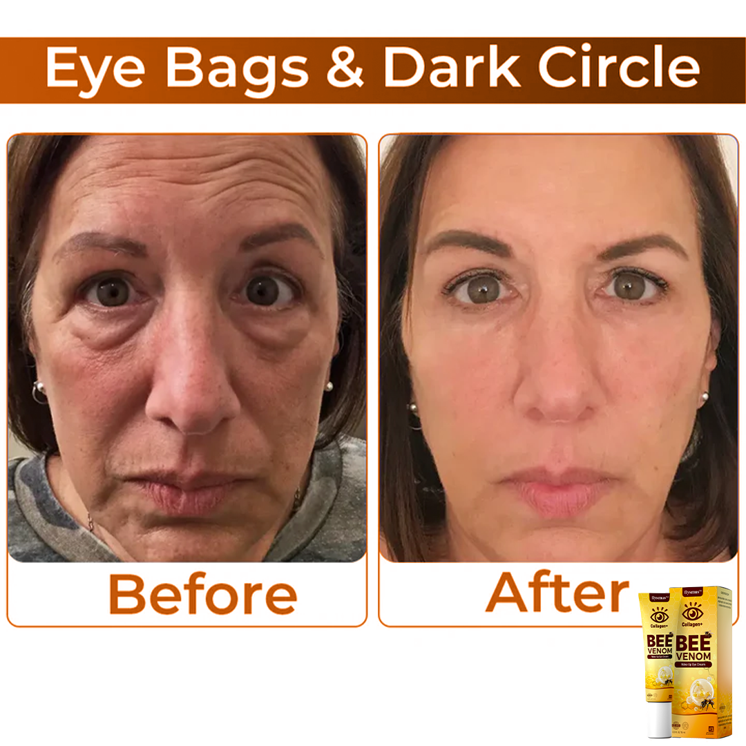 רעל דבורים+קולגן : עוררו את המבט שלכם