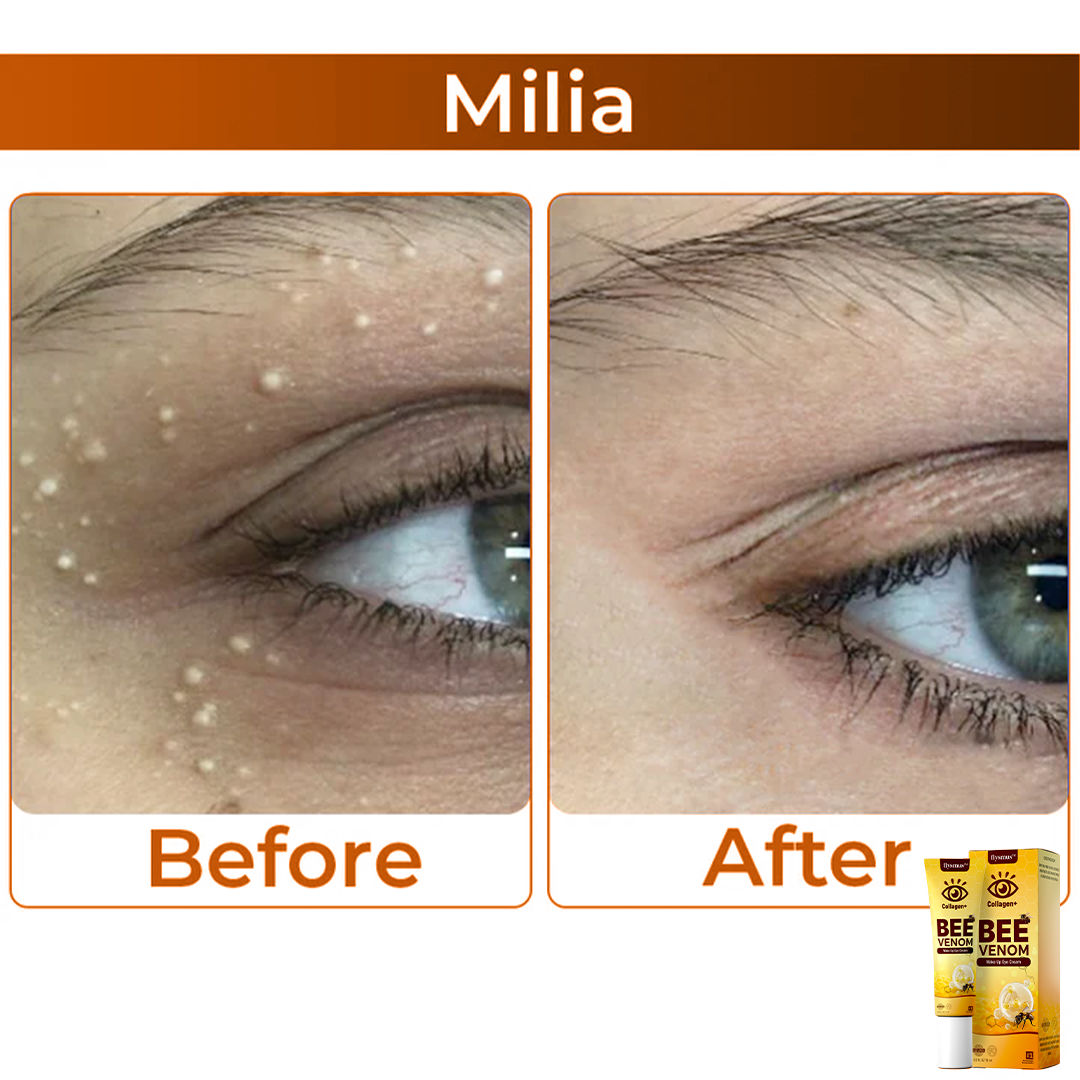 רעל דבורים+קולגן : עוררו את המבט שלכם