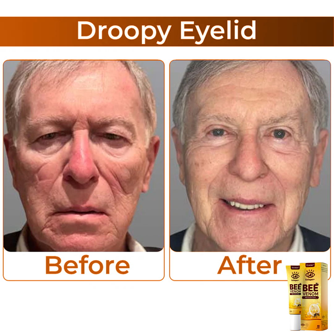 רעל דבורים+קולגן : עוררו את המבט שלכם