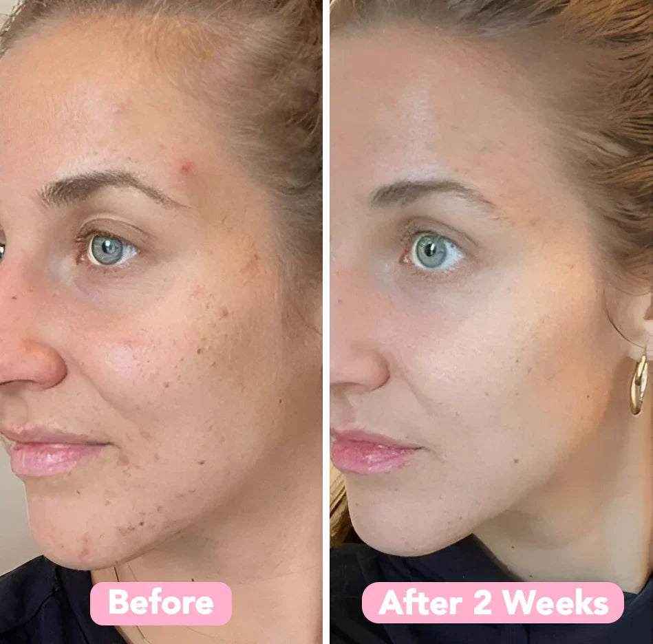 ספוג כורכום – עור נקי ומטוהר באופן טבעי (x40)