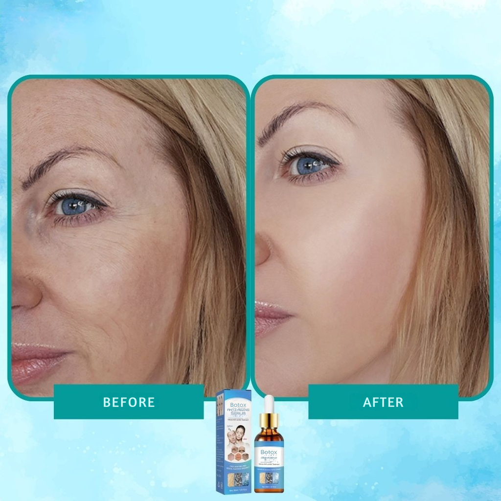 Sérum botox elixír proti vráskam intenzívny 