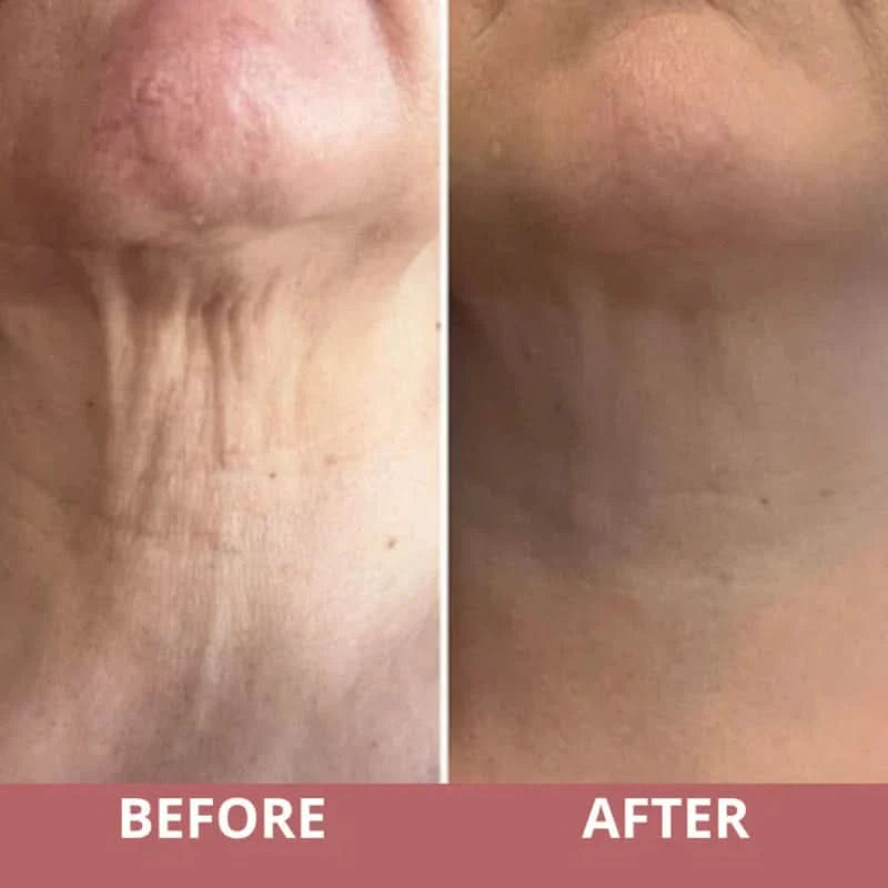 Firming cream for the neck with integrated massager 